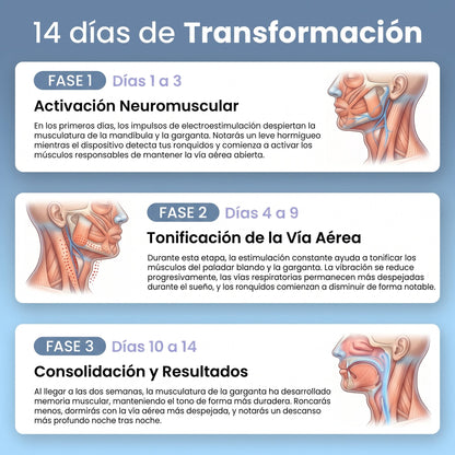 NightMate™ Dispositivo Inteligente Anti-Ronquidos
